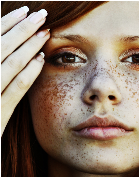 Spring came! | fingers, redhead, freckles