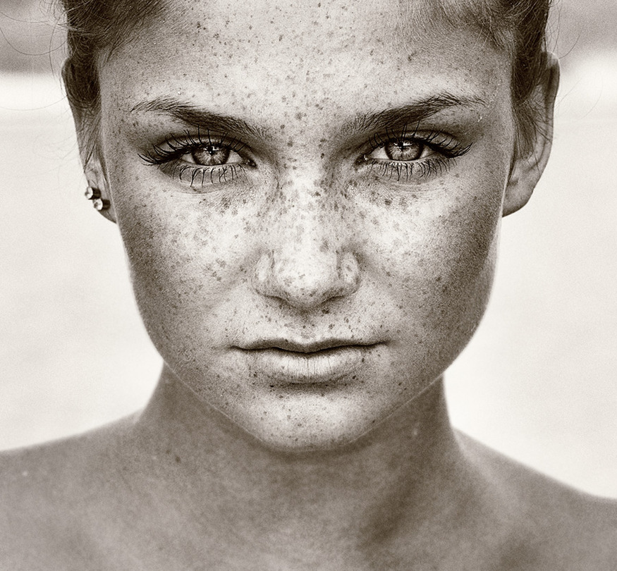 Power | freckles, close-up, black and white